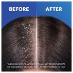 Head/Shoulders Smth/Silky 250Ml Pk6