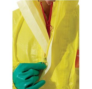 Alphatec 3000 111 Ylw Coverall Xl