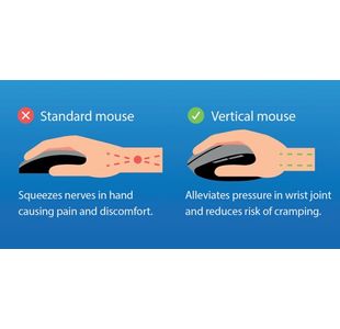 Q-Connect Erg Wls Vertical Rh Mouse